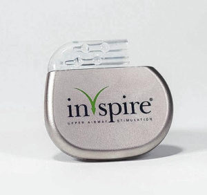 Inspire Medical Systems Inc. stimulation device